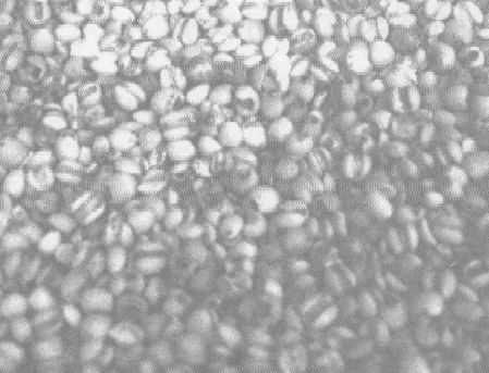 薏米的功效與作用及醫(yī)療處方 薏米的功效與作用