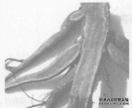 鮮地黃的功效與應(yīng)用實(shí)例 地黃的功效與作用