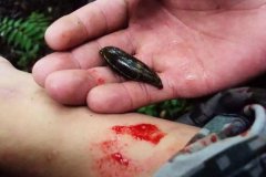 螞蟥咬人怎么辦？螞蟥怎么能殺死？